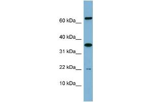 WB Suggested Anti-RWDD1 Antibody Titration: 0. (RWDD1 antibody  (Middle Region))