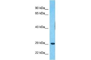 Host:  Rabbit  Target Name:  MDFI  Sample Type:  RPMI-8226 Whole Cell lysates  Antibody Dilution:  1.