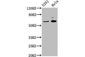 Western Blot Positive WB detected in: U251 whole cell lysate, Hela whole cell lysate All lanes: GABRA4 antibody at 7 μg/mL Secondary Goat polyclonal to rabbit IgG at 1/50000 dilution Predicted band size: 62 kDa Observed band size: 62 kDa