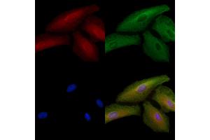 ABIN6264925 and ABIN6278520 staining  cells by IF/ICC.