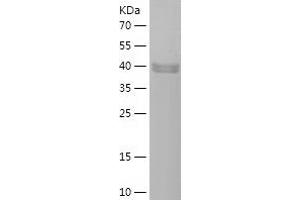 Western Blotting (WB) image for Phospholipase A2-Activating Protein (PLAA) (AA 621-795) protein (His-IF2DI Tag) (ABIN7283973) (PLAA Protein (AA 621-795) (His-IF2DI Tag))