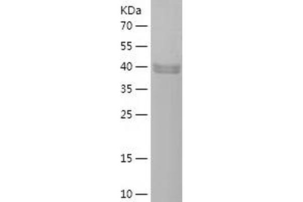 PLAA Protein (AA 621-795) (His-IF2DI Tag)