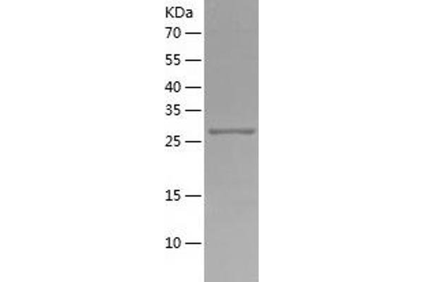 RPS3 Protein (AA 1-263) (His tag)