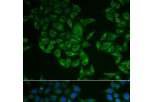 Immunofluorescence analysis of A549 cells using CD247 Polyclonal Antibody (CD247 antibody)