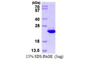 Thioredoxin Domain Containing 12 (Endoplasmic Reticulum) (TXNDC12) (AA 27-172) protein (His tag)