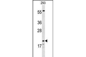 Western blot analysis of CLDN8 Antibody (Center) (ABIN653170 and ABIN2842734) in 293 cell line lysates (35 μg/lane). (CLDN8 antibody  (AA 140-166))