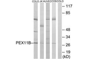 Western blot analysis of extracts from COLO/HuvEc/COS7/Jurkat cells, using PEX11B Antibody.
