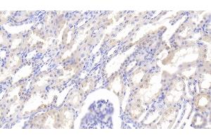 Detection of LEP in Bovine Kidney Tissue using Polyclonal Antibody to Leptin (LEP) (Leptin antibody  (AA 29-160))