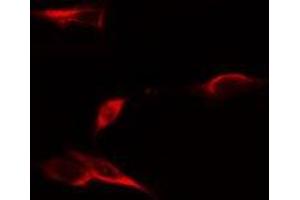 ABIN6275061 staining LOVO cells by IF/ICC. (DPYSL4 antibody  (Internal Region))