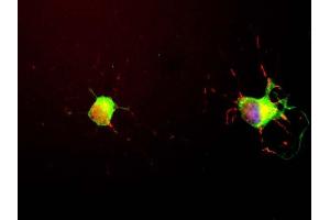 We obtained Neuromics E18 hippocampal neurons and grew them for seven days following the Neuromics protocol. (MAPT antibody)