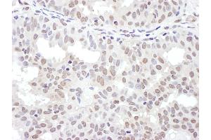 Immunohistochemistry (IHC) image for anti-NFKB Repressing Factor (NKRF) (AA 50-100) antibody (ABIN7455003) (NKRF antibody  (AA 50-100))