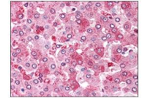 Human Liver: Formalin-Fixed, Paraffin-Embedded (FFPE) (GPC4 antibody  (C-Term))