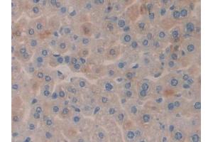 DAB staining on IHC-P; Samples: Mouse Liver Tissue (SGK3 antibody  (AA 141-368))