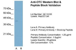 Host:  Rabbit  Target Name:  OTC  Sample Type:  HepG2  Lane A:  Primary Antibody  Lane B:  Primary Antibody + Blocking Peptide  Primary Antibody Concentration:  1. (OTC antibody  (N-Term))