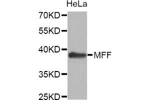 Western blot analysis of extracts of HeLa cell line, using MFF antibody. (MFF antibody)