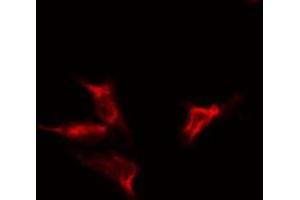 ABIN6275325 staining  HeLa cells by IF/ICC. (NUTF2 antibody  (Internal Region))