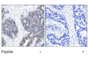 Image no. 1 for anti-Stathmin 1 (STMN1) (Ser37) antibody (ABIN197456)