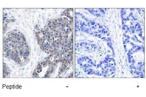 Image no. 1 for anti-Stathmin 1 (STMN1) (Ser37) antibody (ABIN197457) (Stathmin 1 antibody  (Ser37))