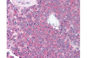 Anti-CD10 antibody IHC of human spleen. (CD101 antibody)
