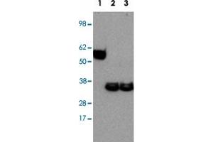 Western blot analysis of Lane 1: Ebi3 recombinant protein Lane 2: mouse bone marrow-derived dendritic cells stimulated with LPS Lane 3: mouse bone marrow-derived dendritic cells stimulated untreated with LPS with Ebi3 monoclonal antibody, clone DNT27 . (EBI3 antibody)