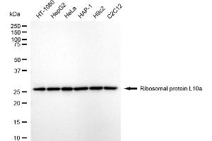 anti-Ribosomal Protein L10a (RPL10A) antibody