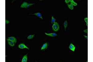 Immunofluorescent analysis of Hela cells using ABIN7172291 at dilution of 1:100 and Alexa Fluor 488-congugated AffiniPure Goat Anti-Rabbit IgG(H+L) (TLL1 antibody  (AA 522-643))