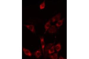 ABIN6275240 staining HepG2 by IF/ICC. (SLC25A21 antibody  (Internal Region))