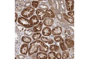 Immunohistochemical staining of human kidney with VPS37A polyclonal antibody  shows strong cytoplasmic positivity in tubular cells.