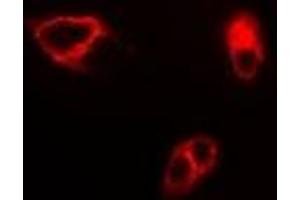 Immunofluorescent analysis of GAS2 staining in SW620 cells. (GAS2 antibody)