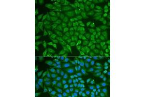 Immunofluorescence analysis of U2OS cells using PIP Polyclonal Antibody (PIP antibody)