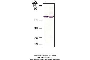 Image no. 1 for anti-Retinal Pigment Epithelium-Specific Protein 65kDa (RPE65) antibody (ABIN363219) (RPE65 antibody)