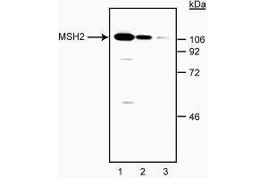 Western blot analysis of MSH-2. (MSH2 antibody)