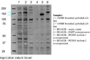 PCDH1 antibody - N-terminal region  validated by WB using bronchial epithelial cell line (16HBE) (Protocadherin 1 antibody  (N-Term))