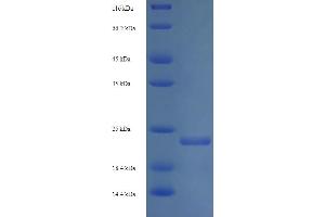 SDS-PAGE (SDS) image for Shiga Toxin Subunit B (STXB) (AA 20-89) protein (His-SUMO Tag) (ABIN5711020) (STXB Protein (AA 20-89) (His-SUMO Tag))