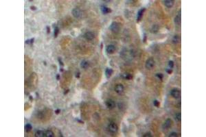Used in DAB staining on fromalin fixed paraffin-embedded Liver tissue (Fatty Acid Synthase antibody  (AA 26-78))