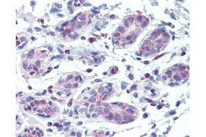 Anti-ABCB5 antibody IHC of human breast. (ABCB5 antibody  (AA 1-30))