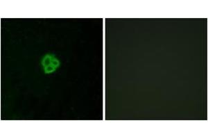 Immunofluorescence analysis of MCF7 cells, using AGTR1 Antibody. (Angiotensin II Type-1 Receptor antibody  (AA 101-150))