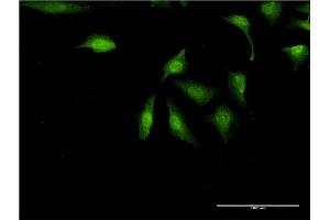 Immunofluorescence of monoclonal antibody to UBE2Z on HeLa cell. (UBE2Z antibody  (AA 136-225))