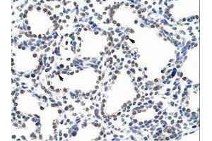 Image no. 1 for anti-Pumilio RNA Binding Family Member 3 (PUM3) (AA 61-110) antibody (ABIN203236) (KIAA0020 antibody  (AA 61-110))