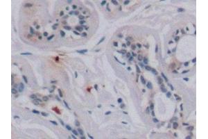 Detection of VEGF165 in Human Mammary gland Tissue using Monoclonal Antibody to Vascular Endothelial Growth Factor 165 (VEGF165) (VEGF 165 (AA 28-191) antibody)