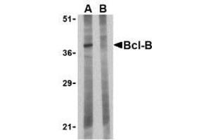Western blot analysis of Bcl-B in Jurkat lysate with AP30130PU-N Bcl-B antibody at 1 µg/ml in the (A) absence and (B) presence of blocking peptide.