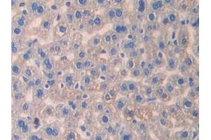 Used in DAB staining on fromalin fixed paraffin- embedded stomach tissue (IL13 Receptor alpha 1 antibody  (AA 28-171))