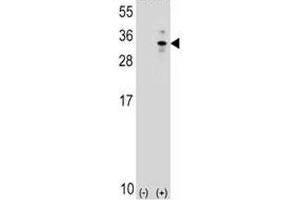 XBP1 antibody  (AA 62-91)