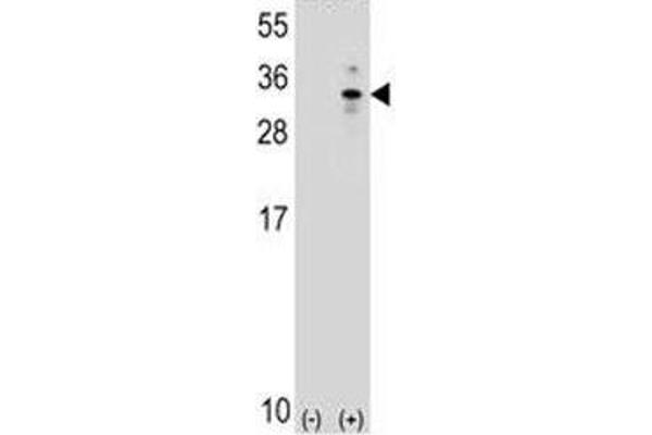 XBP1 antibody  (AA 62-91)