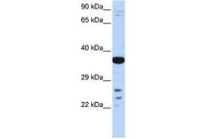Image no. 1 for anti-Visual System Homeobox 1 (VSX1) (AA 108-157) antibody (ABIN6742618) (VSX1 antibody  (AA 108-157))