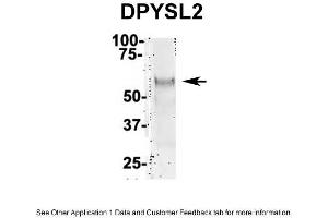 IP Suggested Anti-DPYSL2 Antibody Positive Control: NT2 CELL/BRAIN TISSUE (DPYSL2 antibody  (Middle Region))