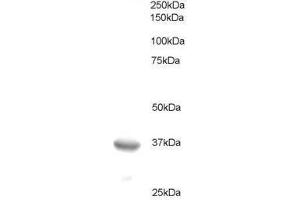 Image no. 1 for anti-B-Cell CLL/lymphoma 7A (BCL7A) (C-Term) antibody (ABIN374064) (BCL7A antibody  (C-Term))