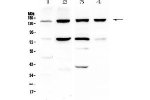 Western blot analysis of Integrin alpha 5 using anti-Integrin alpha 5 antibody . (ITGA5 antibody  (AA 42-263))