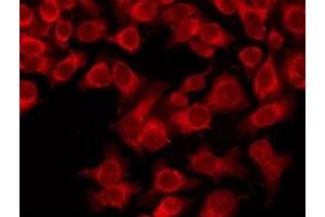 ABIN6274021 staining Hela by IF/ICC. (KIFC1 antibody  (Internal Region))