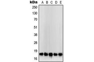 Western blot analysis of SOD1 expression in HeLa (A), MCF7 (B), Jurkat (C), HepG2 (D), DU145 (E) whole cell lysates. (SOD1 antibody  (Center))